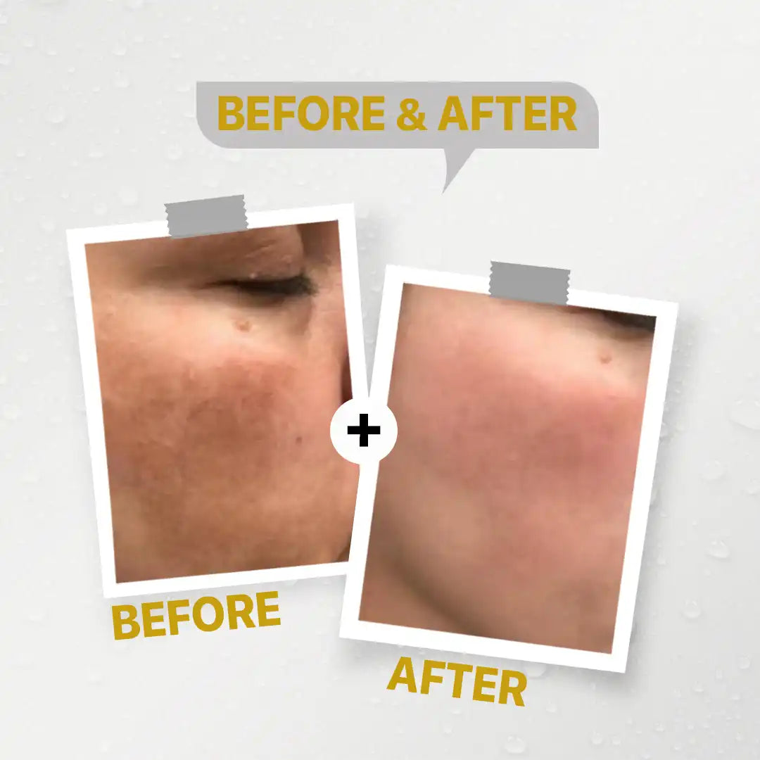 Seelit Professional (30ML)