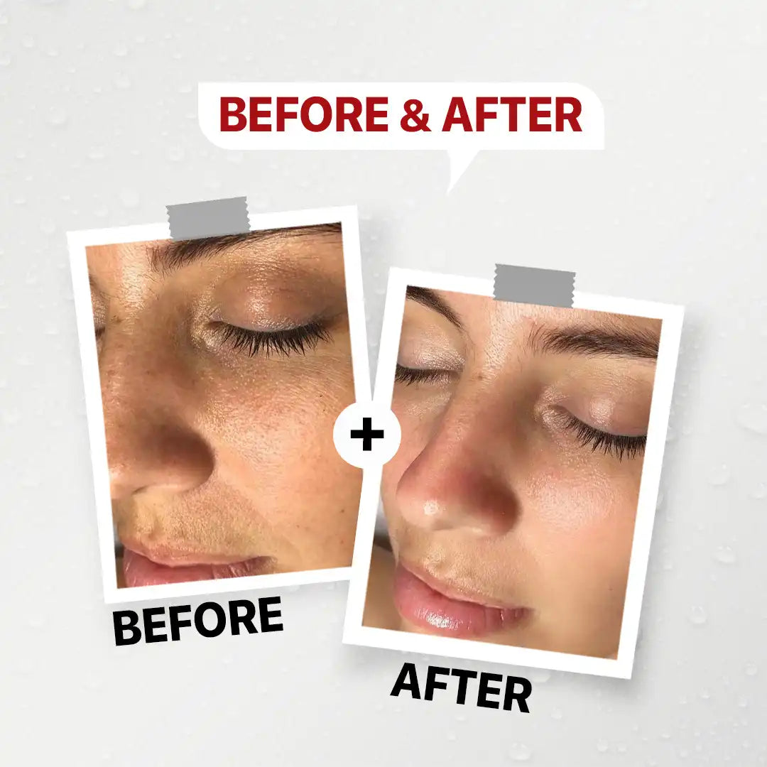 GENFX CENTELLA CICA SERUM (30ml)