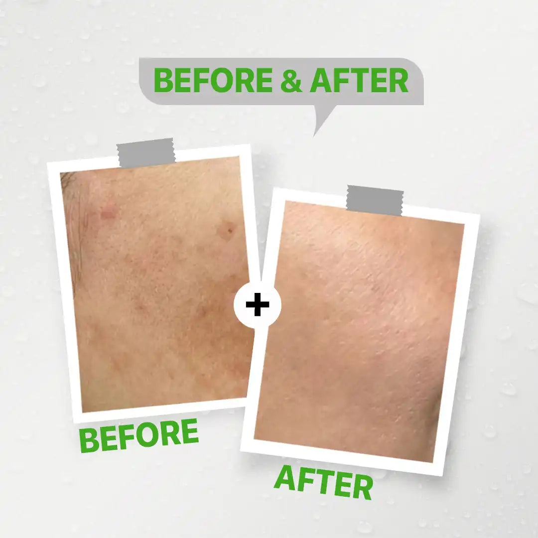 Seelit Retinol B3 serum (30ML)